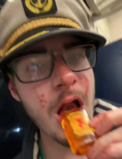 Josh covered in blood, drinking a fireball on the train.